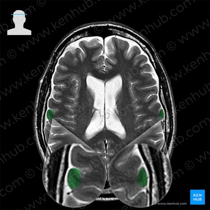 Postcentral gyrus (Gyrus postcentralis); Image: 