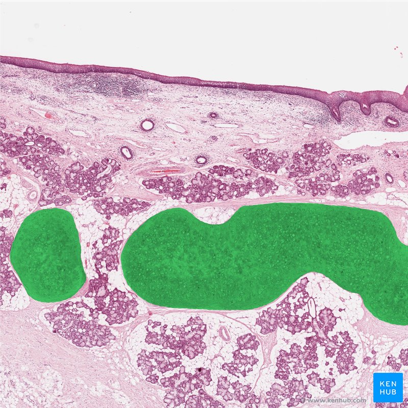 Elastic cartilage: Histological slide