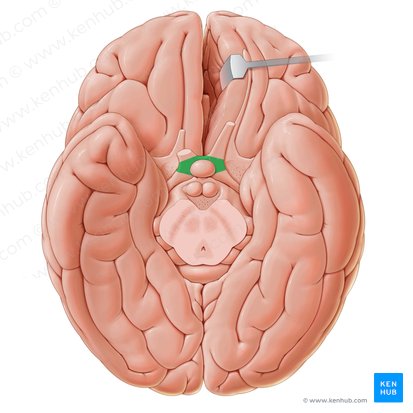 Optic chiasm (Chiasma opticum); Image: Paul Kim
