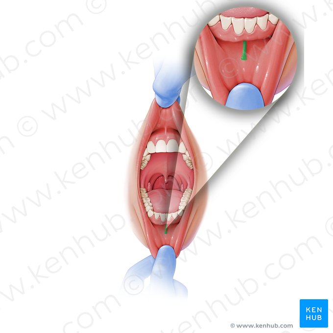 Frenulum of lower lip (Frenulum labii inferioris); Image: Paul Kim