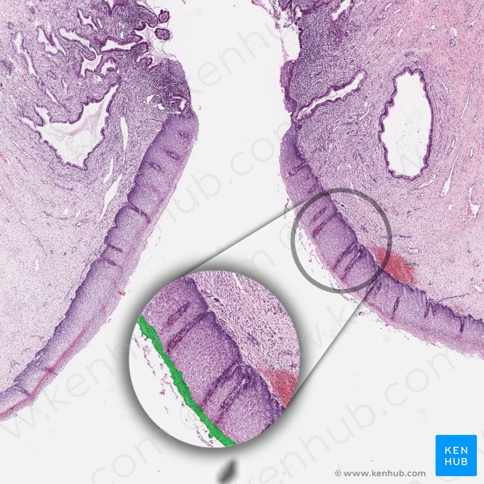 Superficial cell layer of squamous epithelium; Image: 