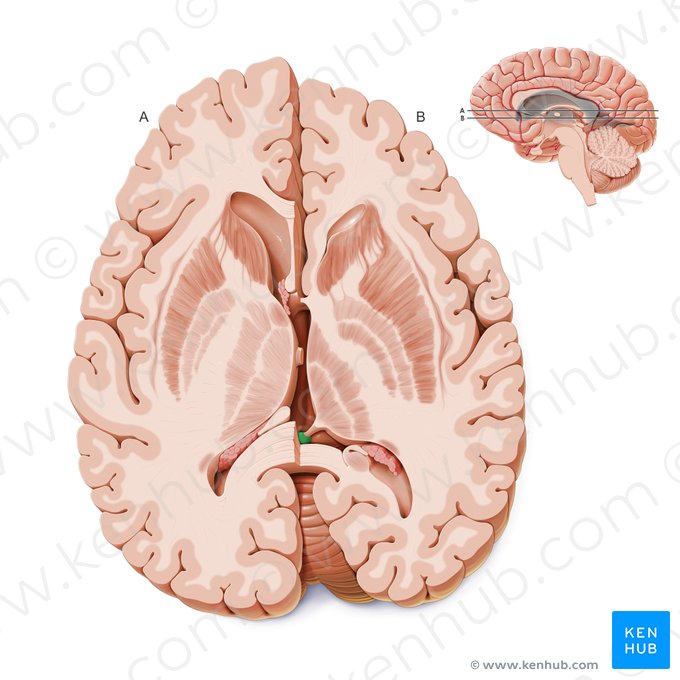 Glândula pineal (Glandula pinealis); Imagem: Paul Kim