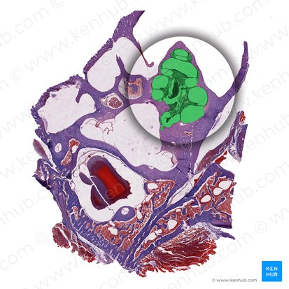 Cóclea (Cochlea); Imagem: 