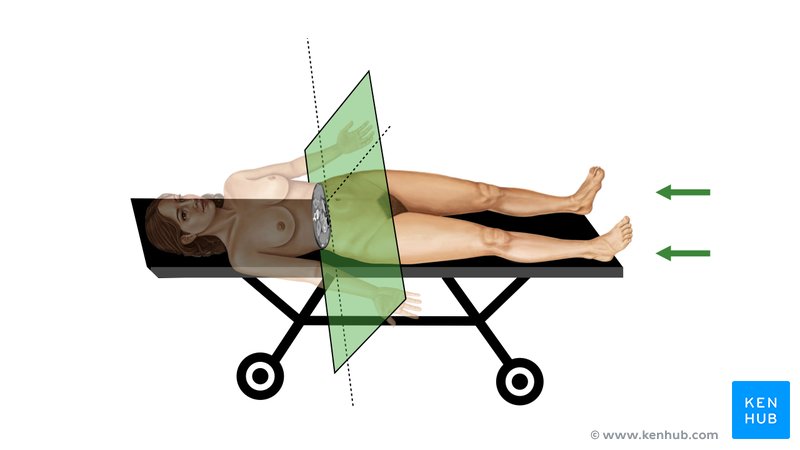 How to orientate with CT scan