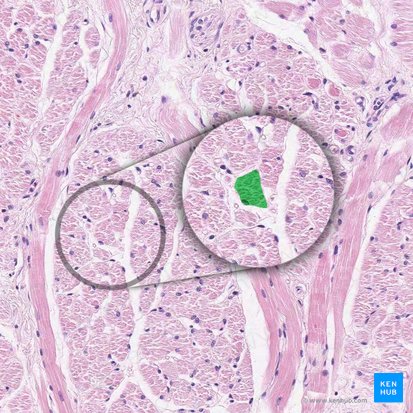 Muscle fiber (Myofibra); Image: 