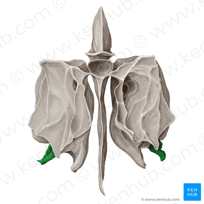 Proceso unciforme del hueso etmoides (Processus uncinatus ossis ethmoidalis); Imagen: Samantha Zimmerman