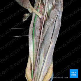 Ramo superficial del nervio radial (Ramus superficialis nervi radialis); Imagen: 