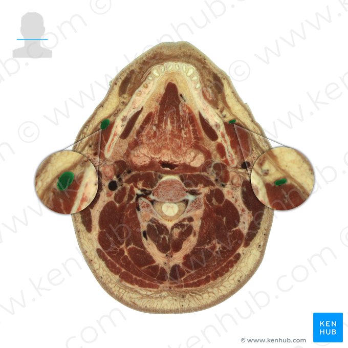 Vena facialis (Gesichtsvene); Bild: National Library of Medicine