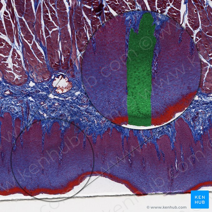 Epitélio escamoso estratificado não queratinizado (Epithelium stratificatum squamosum non cornificatum); Imagem: 