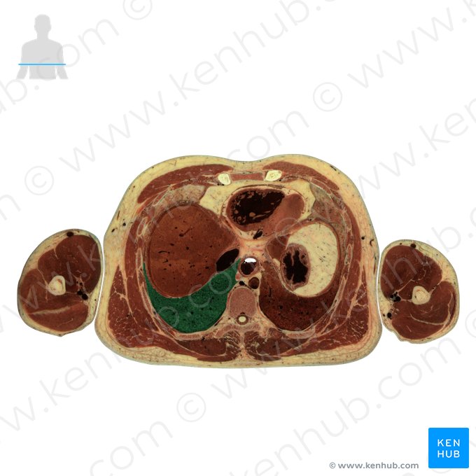 Lobo inferior do pulmão direito (Lobus inferior pulmonis dextri); Imagem: National Library of Medicine