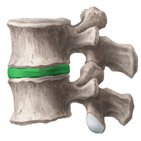 Discos intervertebrales