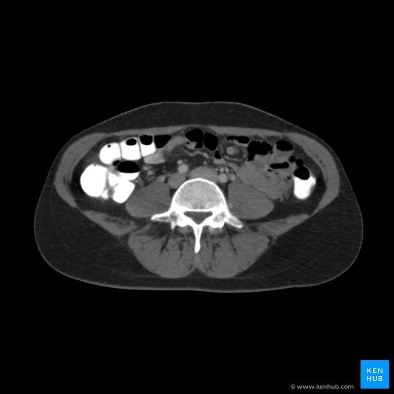 Abdominal Ct How To Read The Abdominal Ct Kenhub