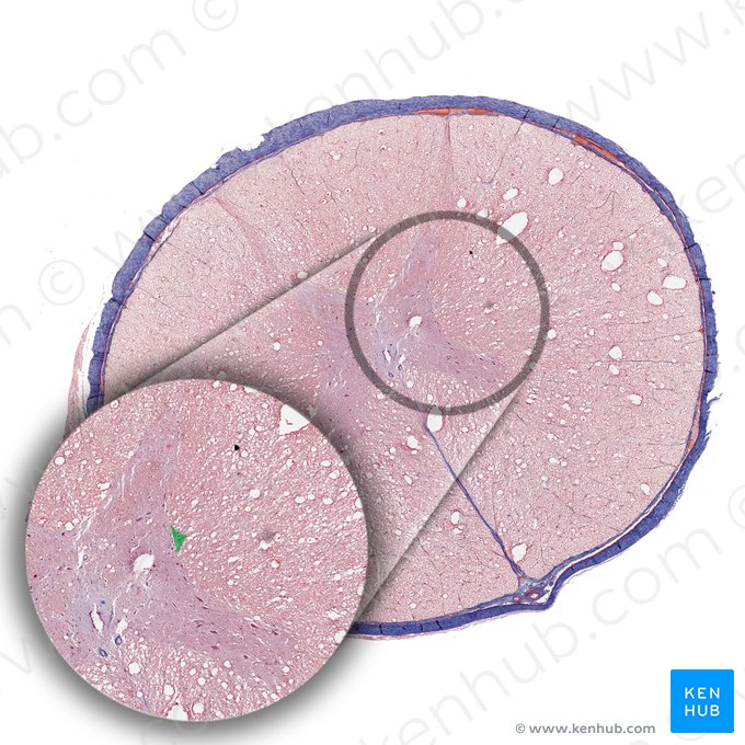 Lateral horn of spinal cord (Cornu laterale medullae spinalis); Image: 