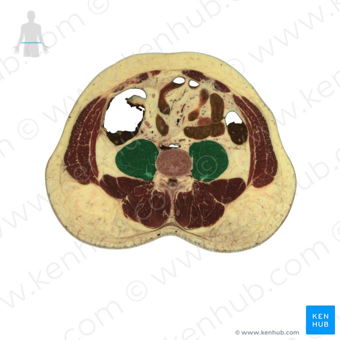 Musculus psoas major (Großer Lendenmuskel); Bild: National Library of Medicine