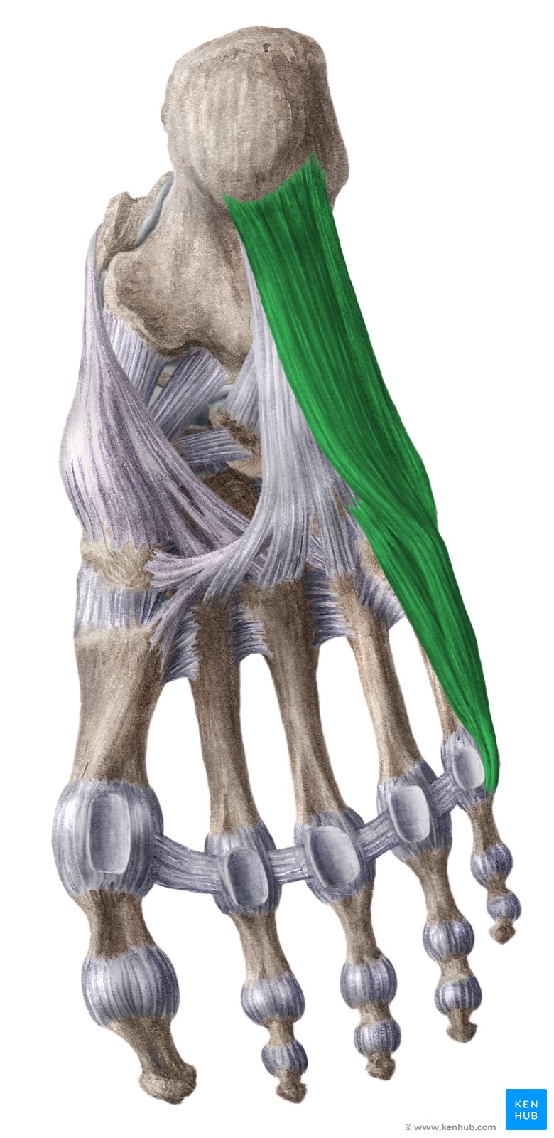 Lateral foot top