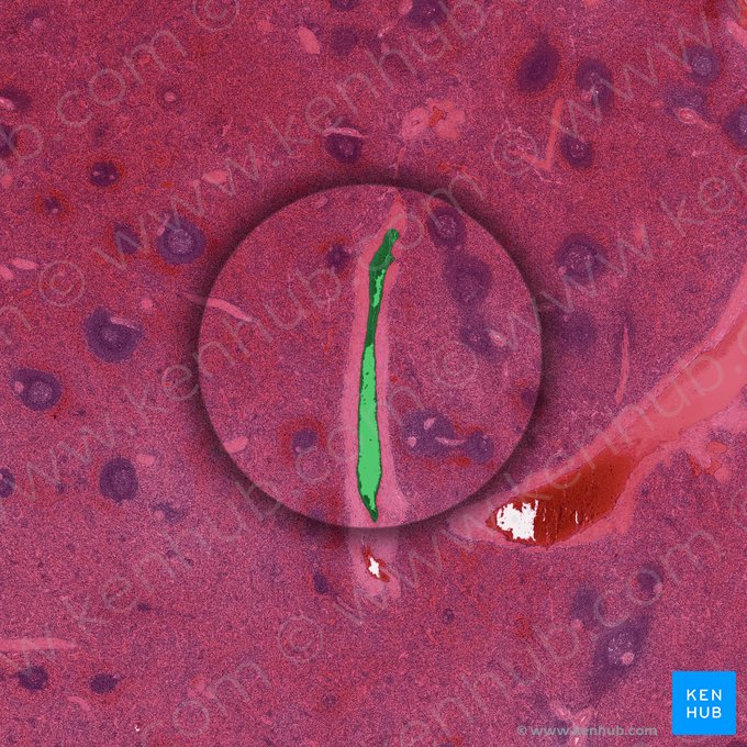 Veia trabecular do baço (Vena trabecularis splenis); Imagem: 