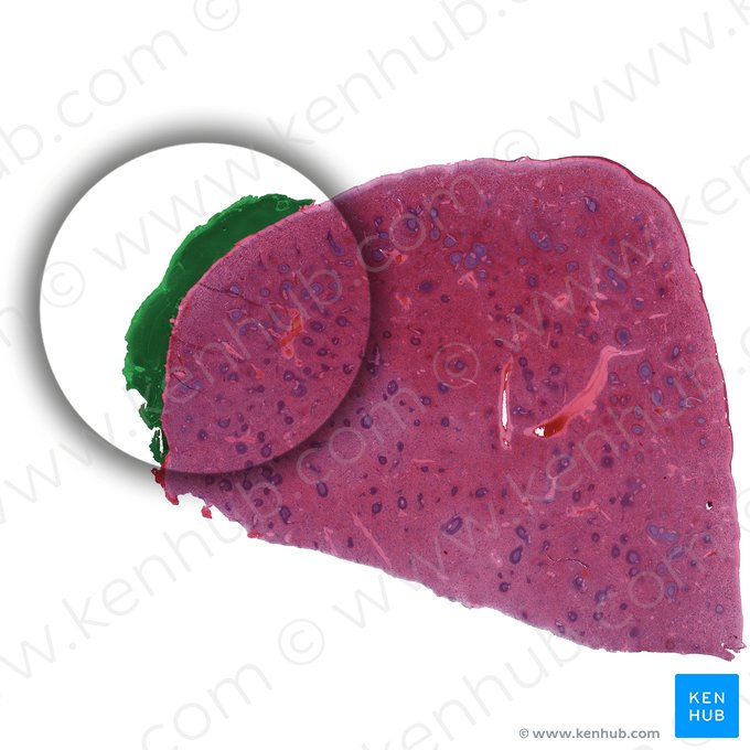 Hilo do baço (Hilum splenis); Imagem: 