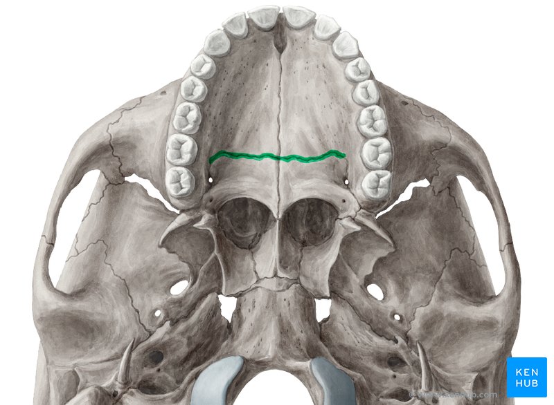 Transverse palatine suture