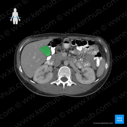 Gallbladder (Vesica biliaris); Image: 