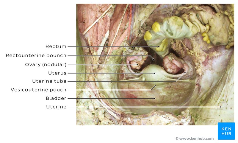 Ovaries and neighbouring structures inside a cadaver