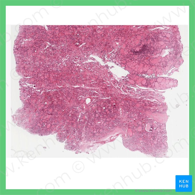 Glándula tiroides (Glandula thyroidea); Imagen: 