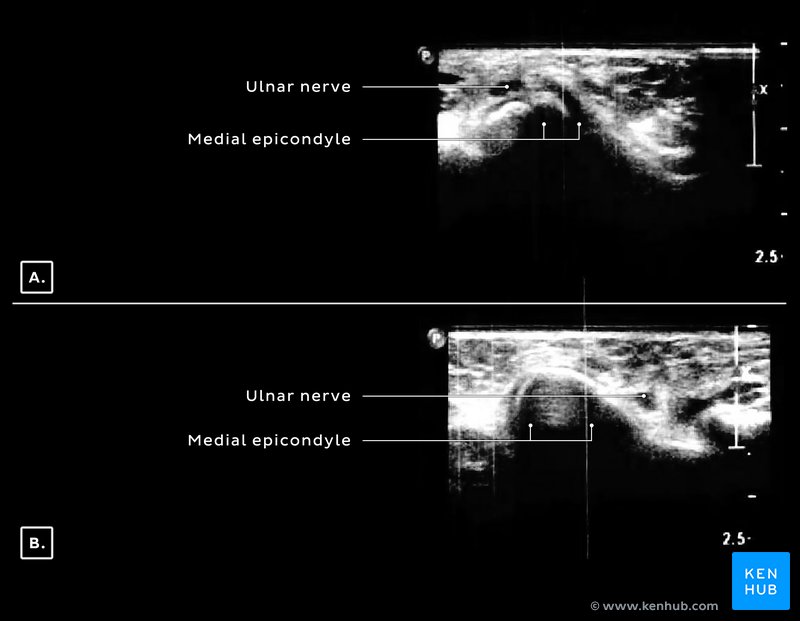 Dynamic ultrasound