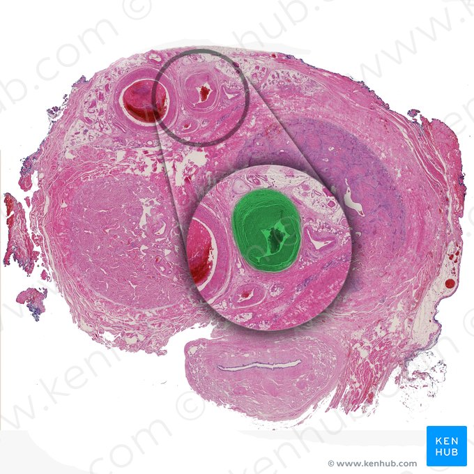 Arteria dorsal del pene (Arteria dorsalis penis); Imagen: 