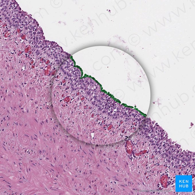 Cellules en parapluie (Urotheliocyti superficiales); Image : 