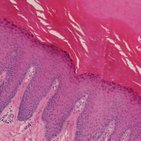 Stratified epithelium