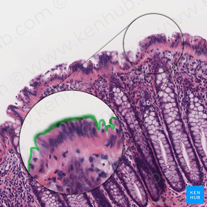 Borda em escova de colonócito (Limbus microvillosus colonocyti); Imagem: 