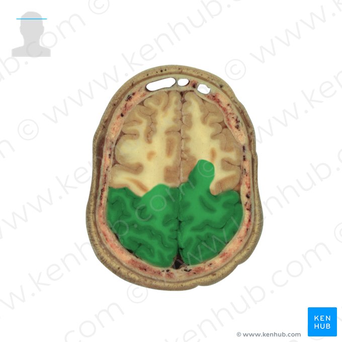 Parietal lobe (Lobus parietalis); Image: National Library of Medicine