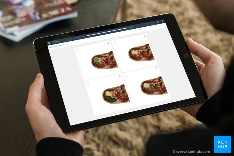A quiz on cadaveric anatomy images on a tablet.