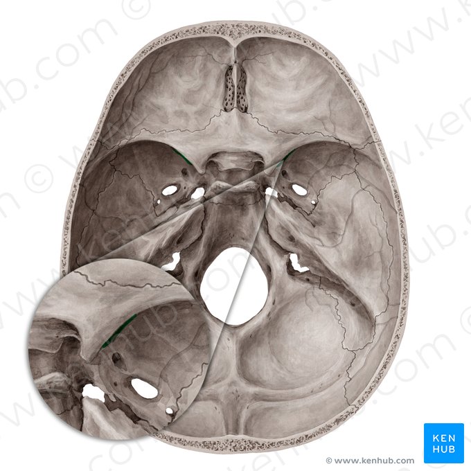Fissura orbitalis superior (Obere Augenhöhlenspalte); Bild: Yousun Koh