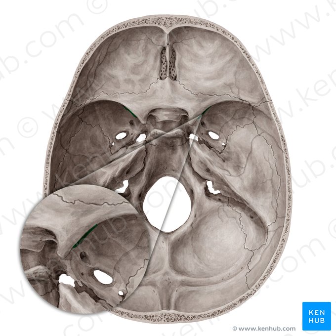 Fissura orbital superior (Fissura orbitalis superior); Imagem: Yousun Koh