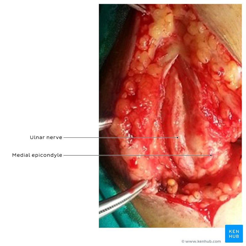 Ulnar nerve