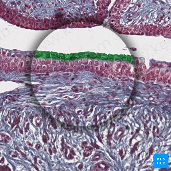 Superficial layer of transitional epithelium; Image: 