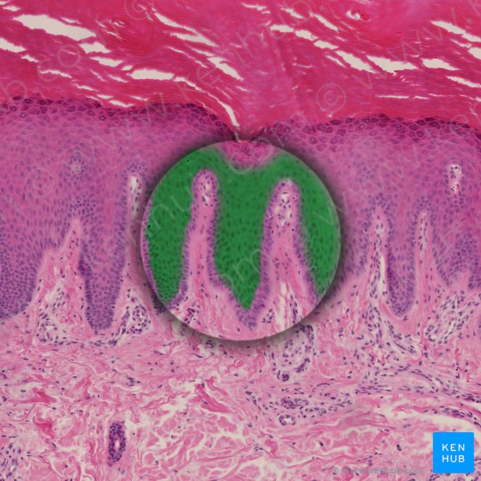 Stratum spinosum of epidermis (Stratum spinosum epidermis); Image: 