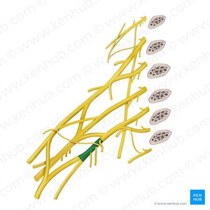 Fasciculus medialis plexus brachialis (Mittleres Bündel des Armgeflechts); Bild: Begoña Rodriguez