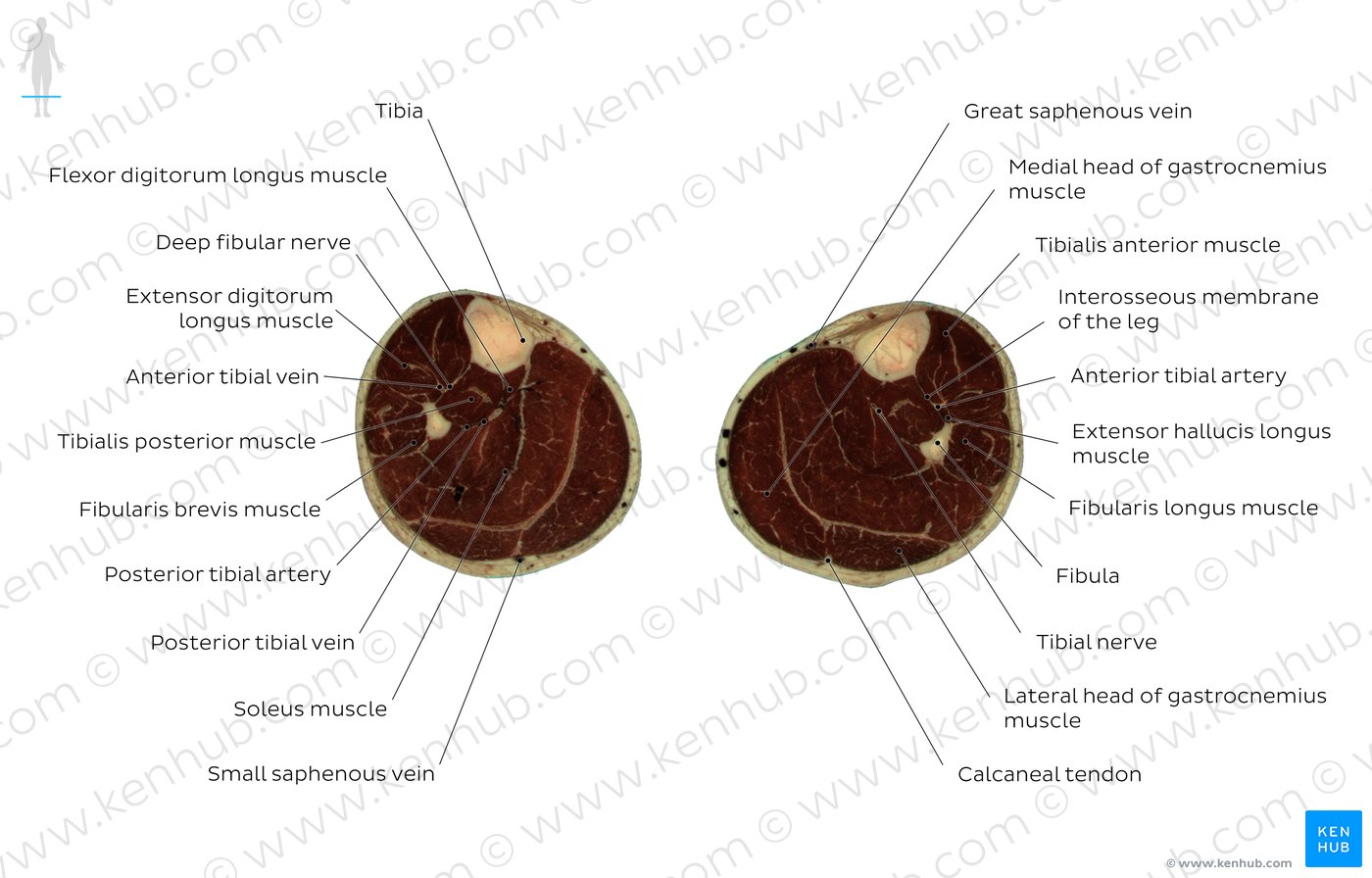 Cross section of the leg through the soleus muscle: Diagram