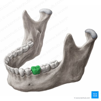 Dens molaris primus sinister mandibularis (Linker unterer erster Molar); Bild: 