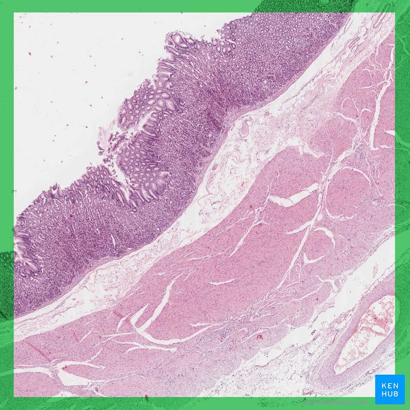 Gastric body - histological slide