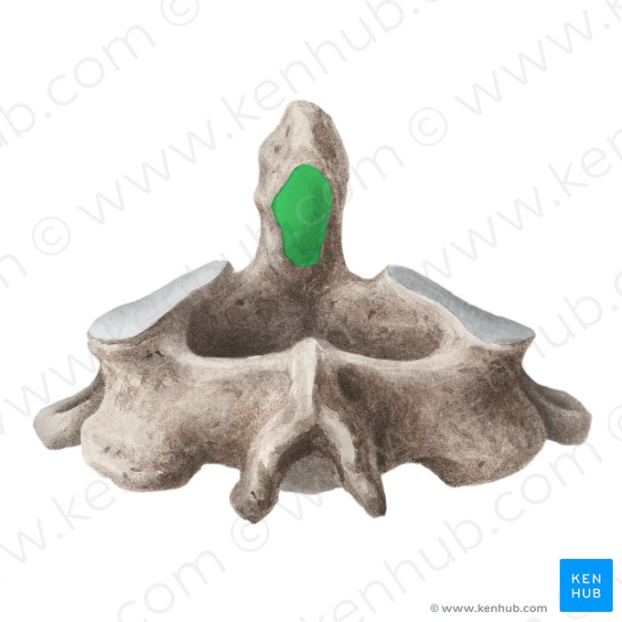 Carilla articular posterior del diente del axis (Facies articularis posterior dentis axis); Imagen: Liene Znotina