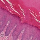 Histologie der Haut