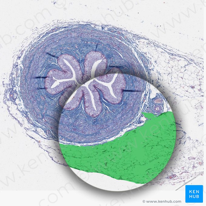 Grasa retroperitoneal; Imagen: 