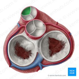 Cúspide semilunar anterior da valva pulmonar (Valvula semilunaris anterior valvae trunci pulmonalis); Imagem: Yousun Koh