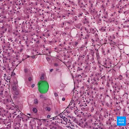 Cellula perisinusoidalis (Ito-Zelle); Bild: 