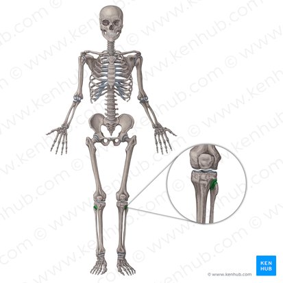 Articulación tibiofibular proximal (Articulatio tibiofibularis superior); Imagen: Irina Münstermann