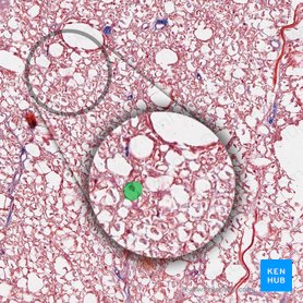 Myelinated axon (Axon myelinatum); Image: 