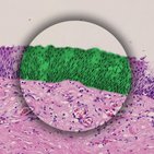 Mehrschichtiges Epithel - Histologie