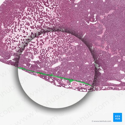 Connective tissue septum (Septum textus connectivi); Image: 
